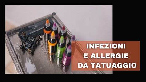 Schema delle cause di infezione da tatuaggio: igiene, strumenti, inchiostri, cura del paziente.