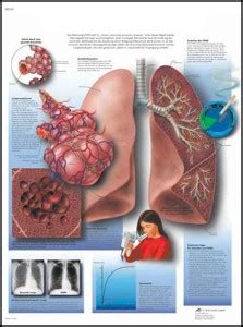 Schema di funzionamento di un broncodilatatore che agisce sui muscoli delle vie aeree