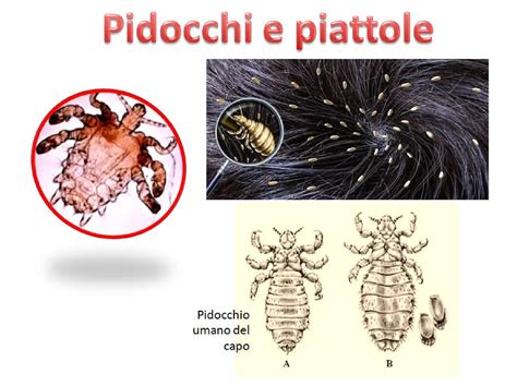 Immagine dermatoscopica di pidocchi del pube e delle loro uova sulla cute