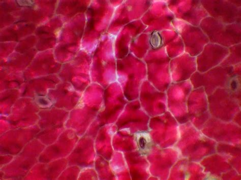 Microfotografia di cellule di radicchio rosso durante la plasmolisi, con antociani concentrati al centro