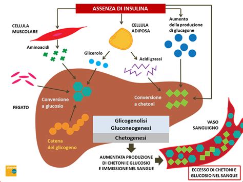 Schema che illustra la differenza tra chetosi nutrizionale e chetoacidosi diabetica.