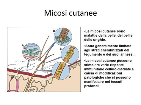 Schema che illustra le diverse modalità di trattamento delle micosi cutanee (topico vs orale) e le loro indicazioni