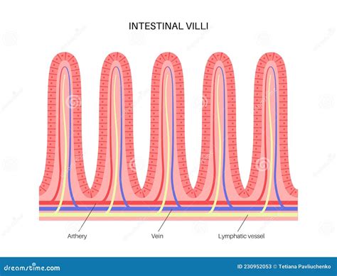Illustrazione dei villi intestinali sani e atrofizzati