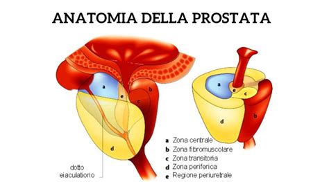 Illustrazione che mostra la compressione del retto da parte di una prostata ingrossata.