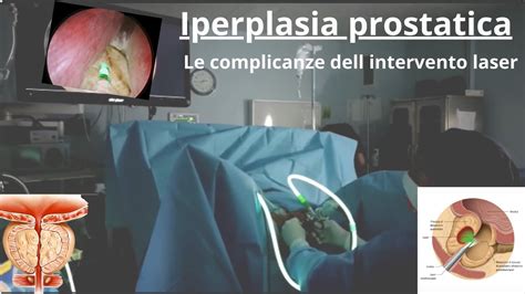 Immagine ecografica di una prostata ingrossata con presenza di cisti.