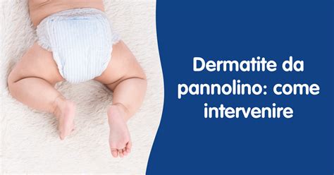 Bambino con eritema da pannolino nella zona del sederino