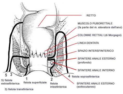 Illustrazione anatomica che evidenzia la struttura dello sfintere anale e la mucosa rettale, mostrando le potenziali aree di lesione durante il sesso anale.