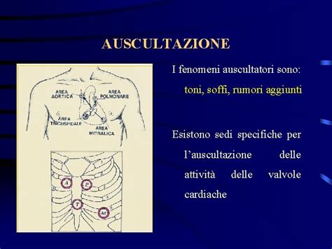 Schema delle zone di auscultazione polmonare